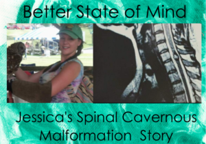 Better State of Mind: Jessica's Spinal Cavernous Malformation Story. Image of Jessica wearing a baseball cap and holding an owl. And an MRI image showing a spinal cavernous malformation.