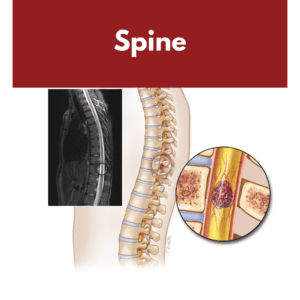 Spine